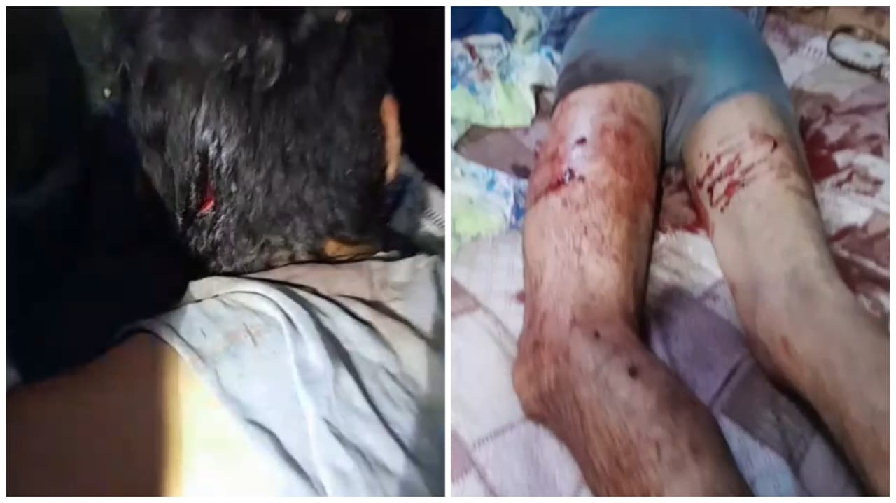 Vaqueiro atacado no Pantanal é resgatado de helicóptero e passa por cirurgia na Santa Casa. Ele segue estável; ICMBio e Ibama acompanham o caso